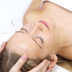 acupuncture
